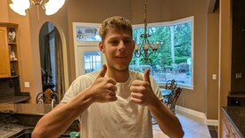 Highlight for Album: 20250512_Andrew_wisdom_teeth_removal